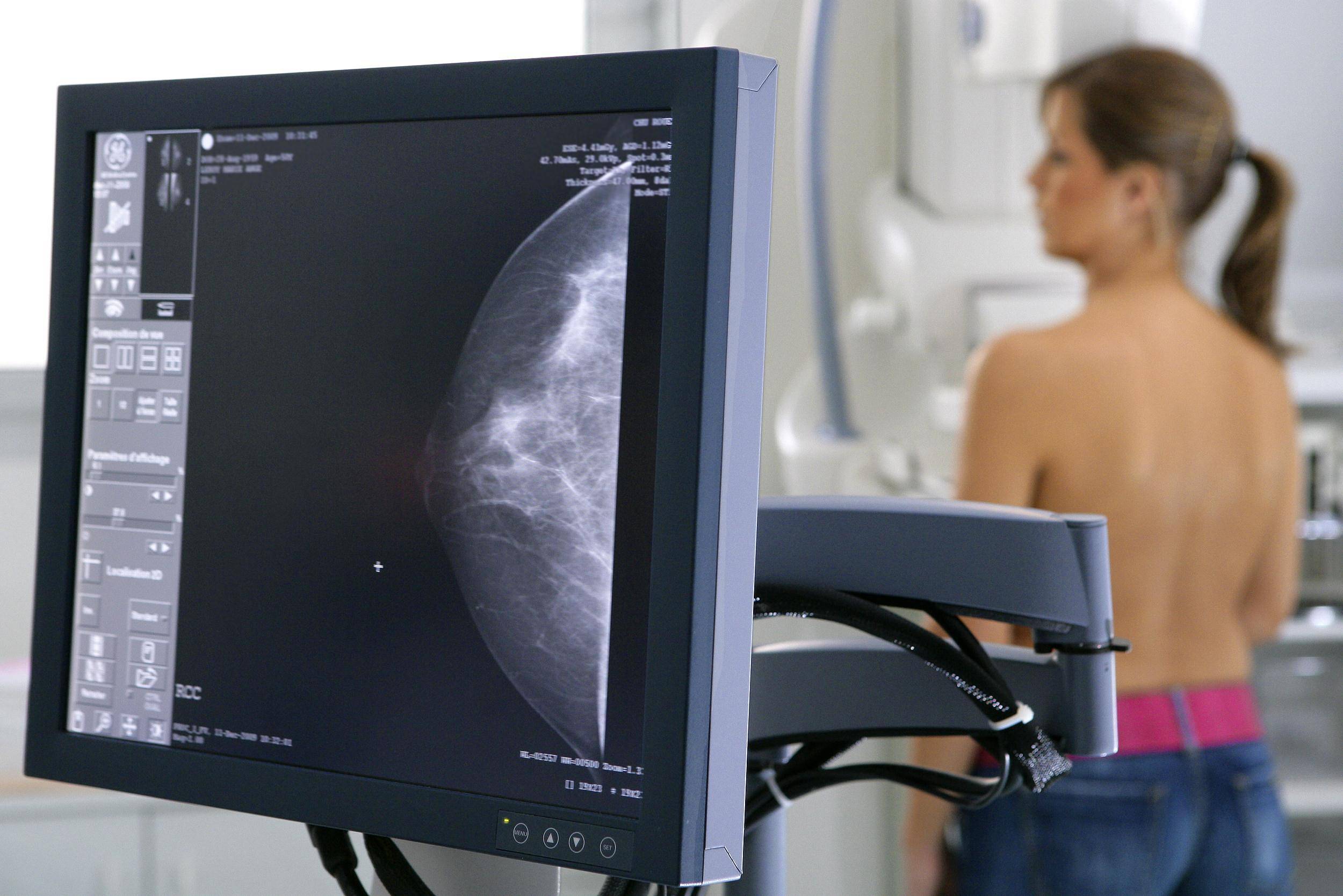 как делают маммографию груди у женщин фото 61